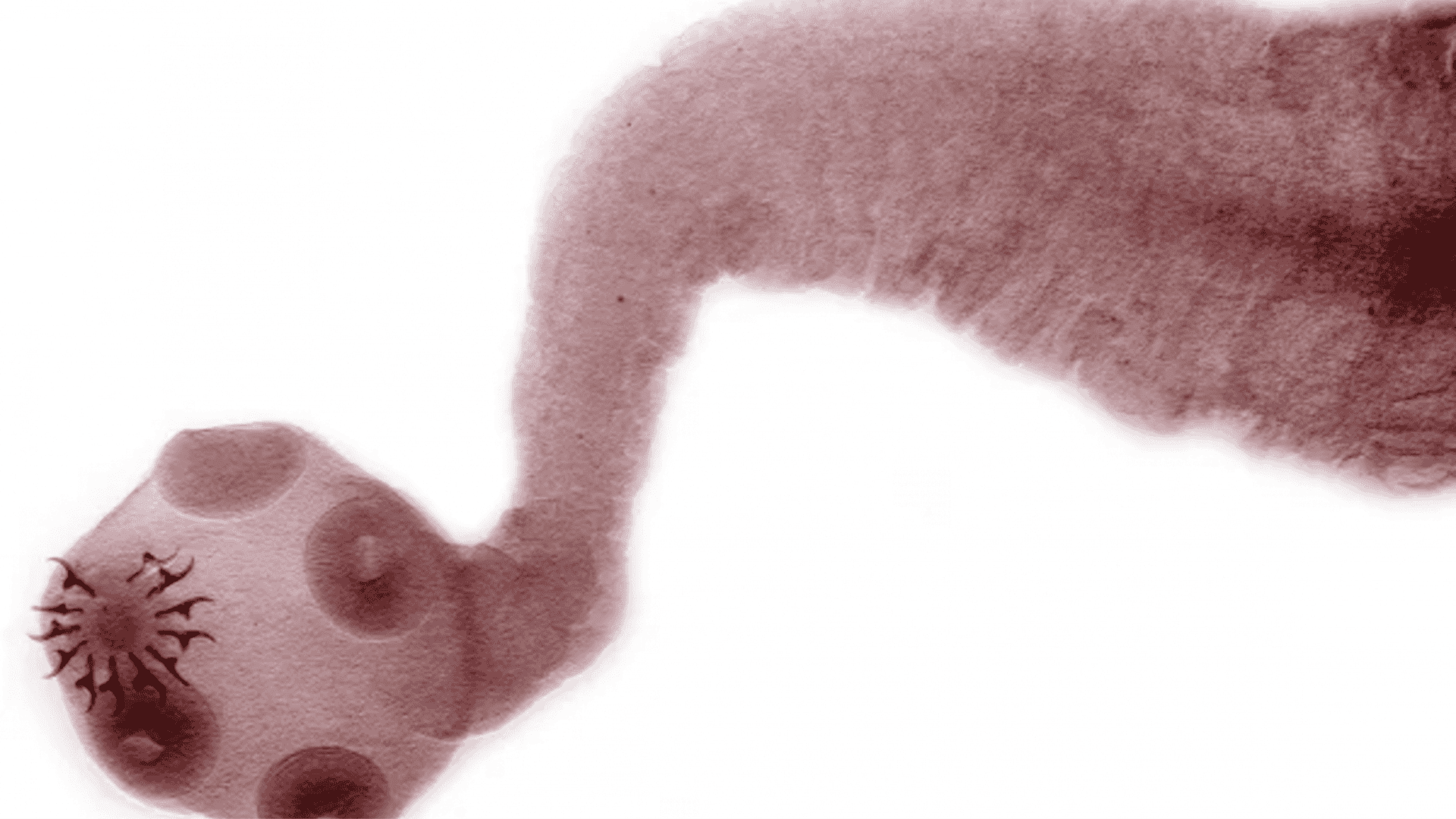 imagem mostra um close up de uma captura microscópica do bicho do corpo: o parasita Taenia solium