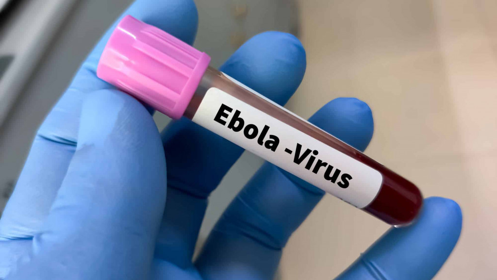 ebola