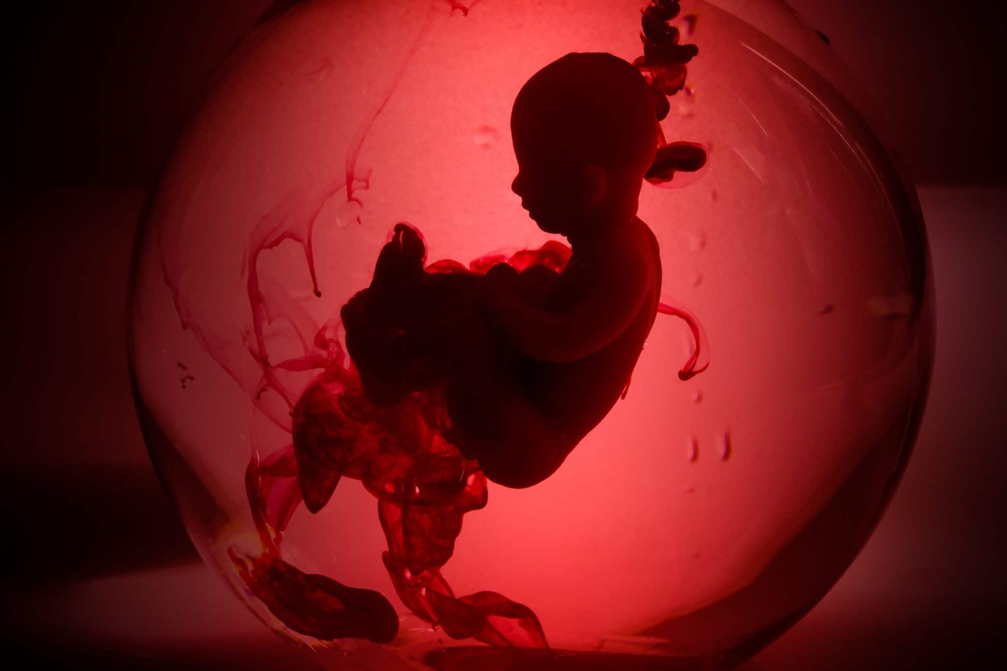 Médicos operam coração de feto dentro da barriga da mãe