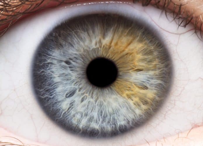 iStock-889317852-1-695x500