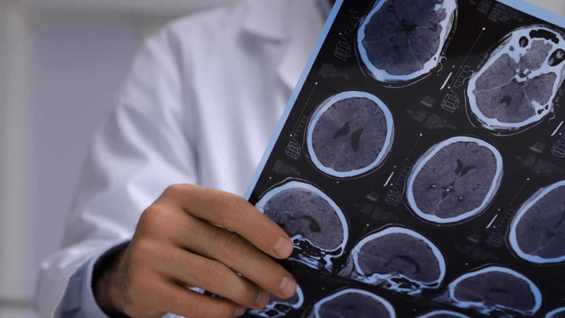 lesao cerebral
