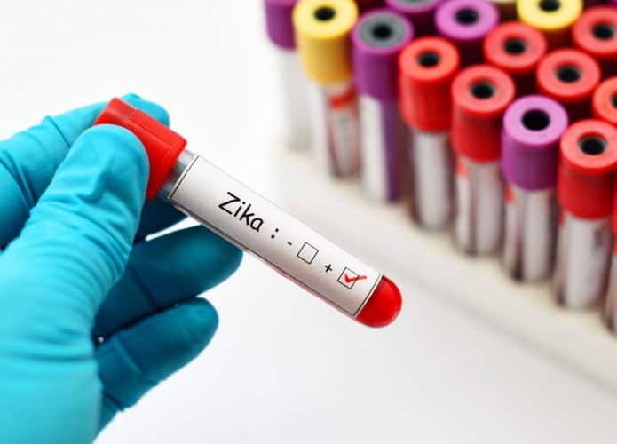 Amostra de sangue em um recipiente com etiqueta ecrito 