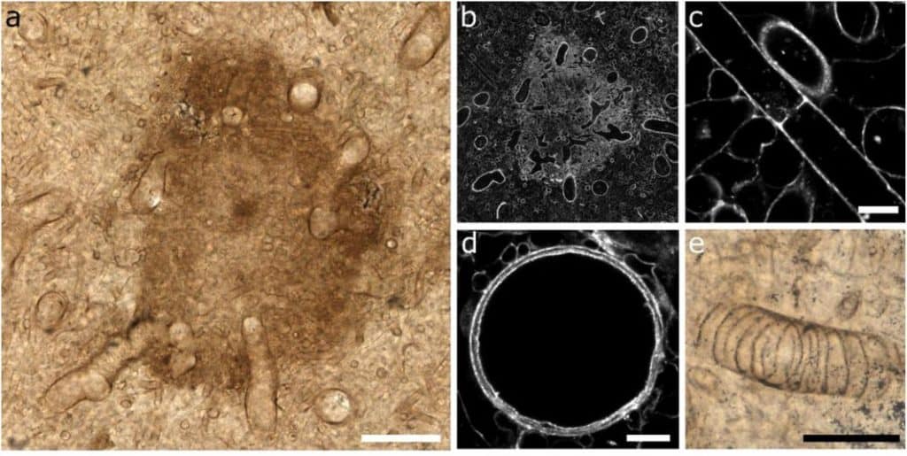 As manchas medulares e os tipos de tubo de Prototaxites taiti são distintos de qualquer coisa observada em grupos de fungos extintos ou existentes.