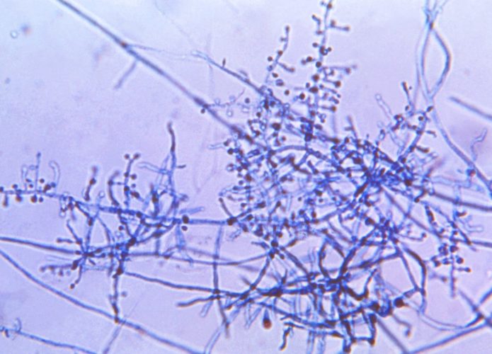 fungo-Trichophyton-indotineae-1-695x500
