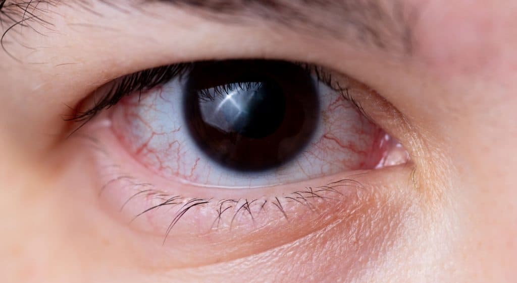 retina
