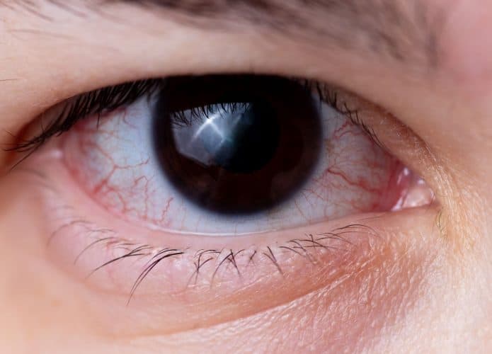 retina
