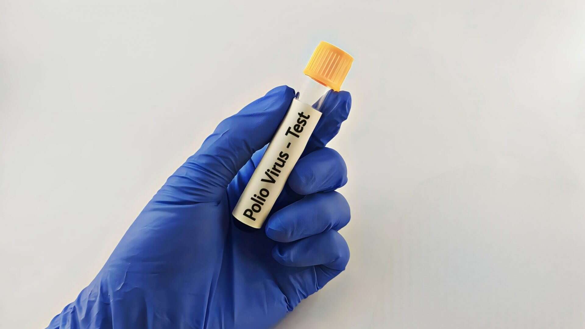 virus polio