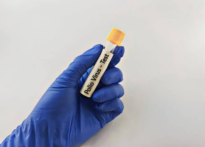 virus polio