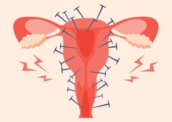 ilustração demonstrando como é a sensação de dor da cólica