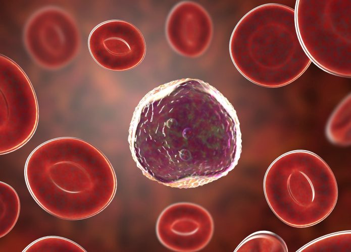 cancer sangue