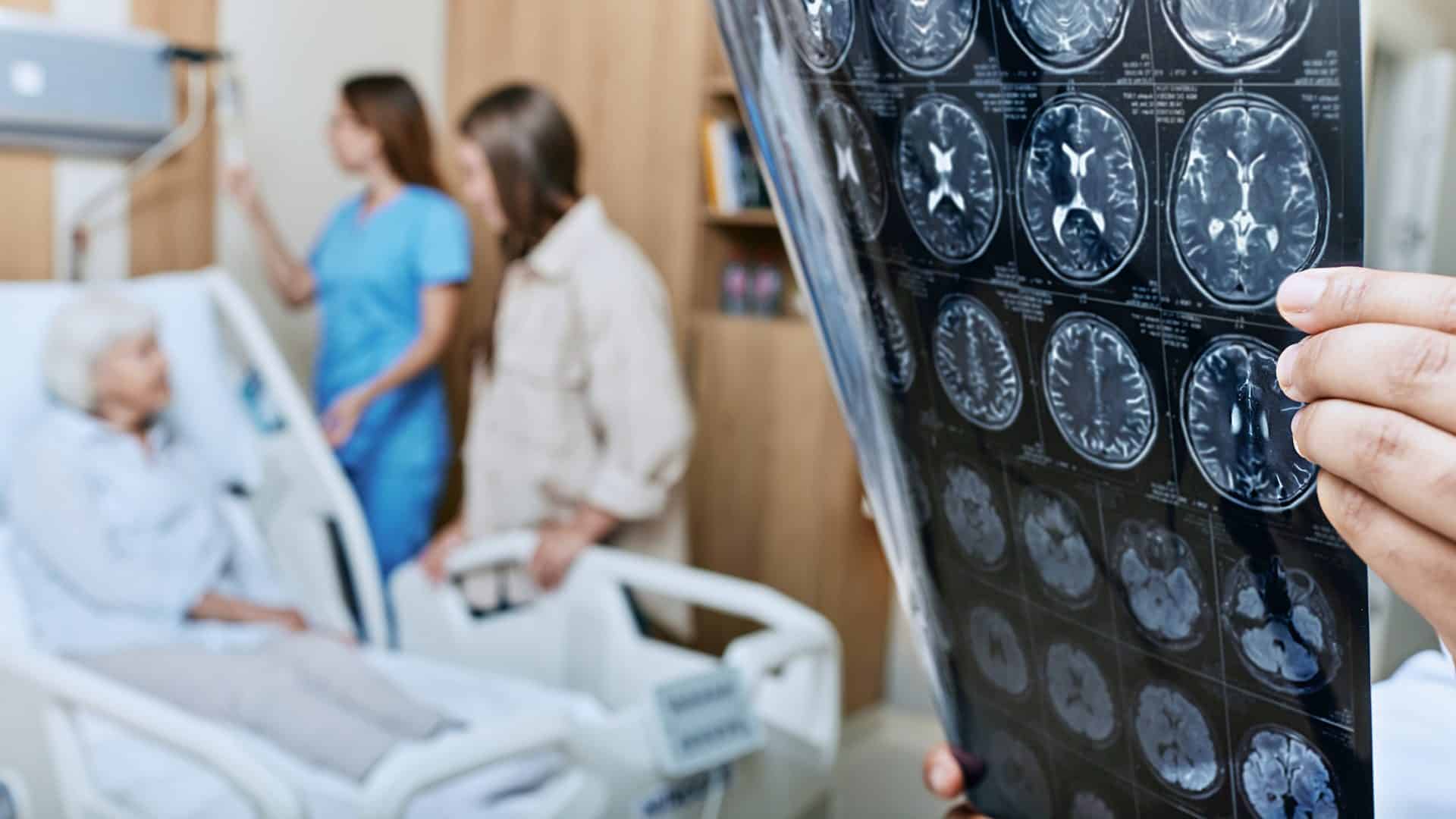 Pessoa acamada com duas mulheres olhando-a em pé e, à frente, um médico segurando exames de tomografia cerebral