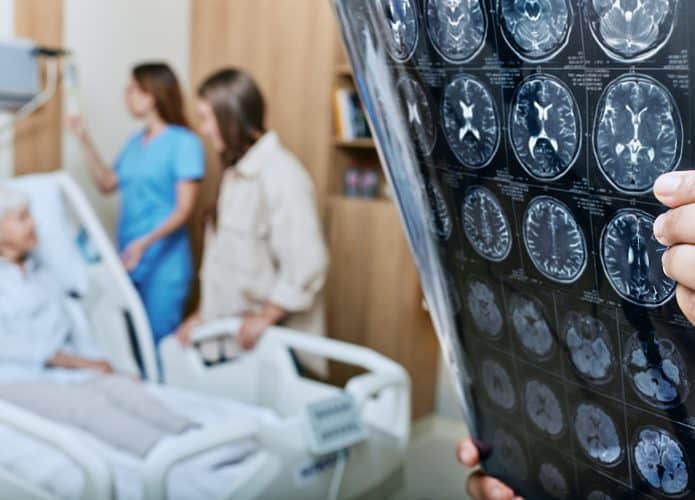 Pessoa acamada com duas mulheres olhando-a em pé e, à frente, um médico segurando exames de tomografia cerebral