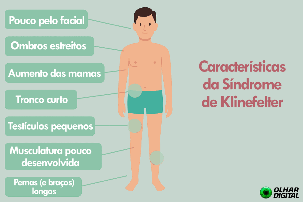 síndrome de klinefelter