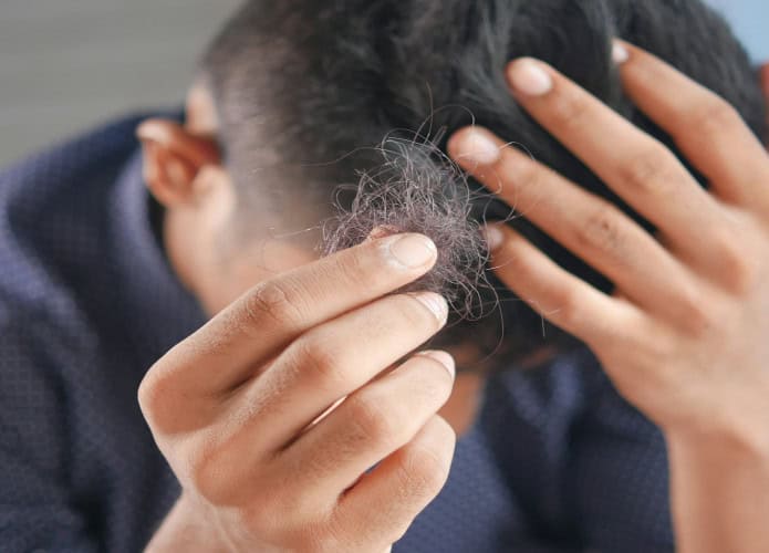 Homem segurando tufo de cabelo com uma mão e escondendo a cabeça com a outra
