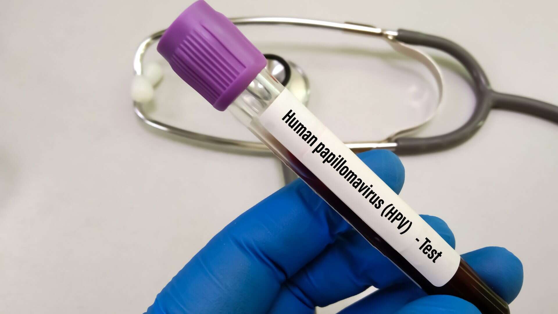 Vidro de armazenamento com etiqueta escrito o nome do HPV