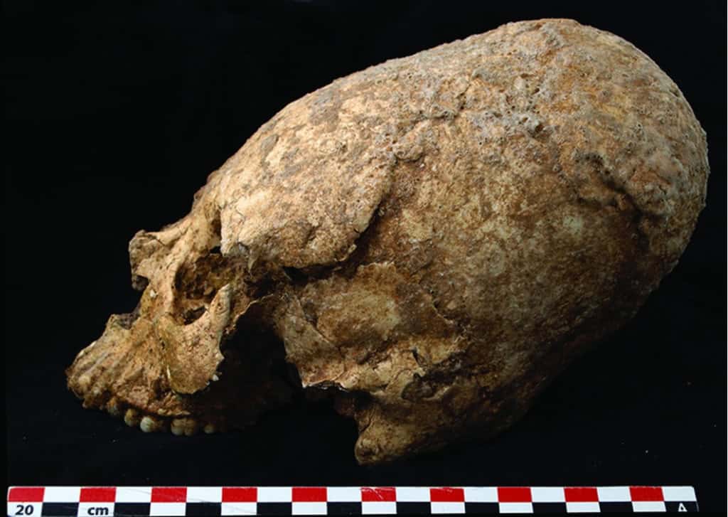 Exemplar de crânio alongado descoberto pela equipe do Zohreh Preehistoric Project. 