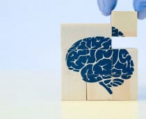 alzheimer