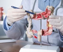 Médico apontando caneta para parte de dentro de maquete de intestino grosso