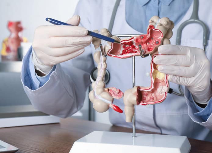 Médico apontando caneta para parte de dentro de maquete de intestino grosso