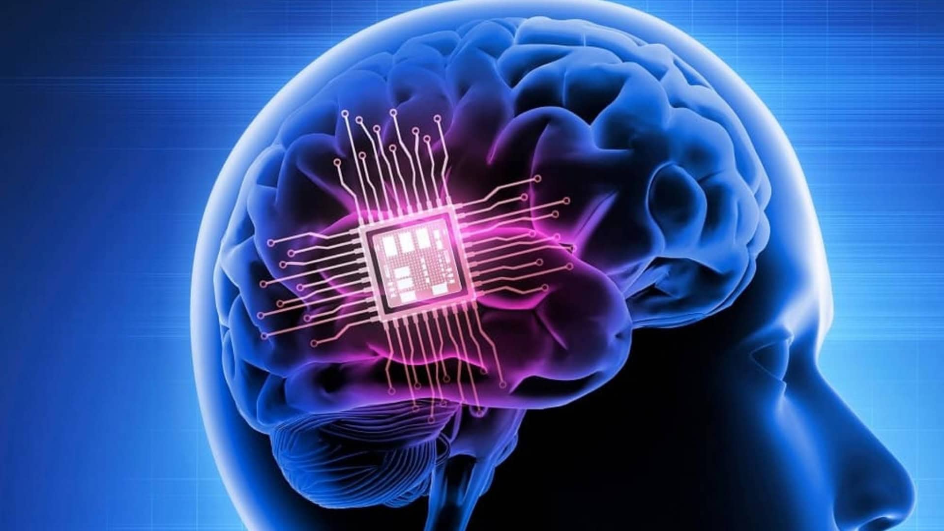 chip-cerebral-1-1920x1080