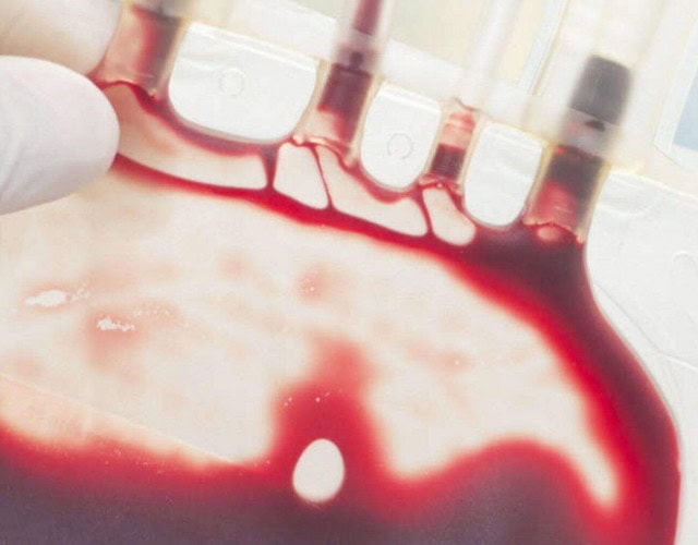 Capa - sangue