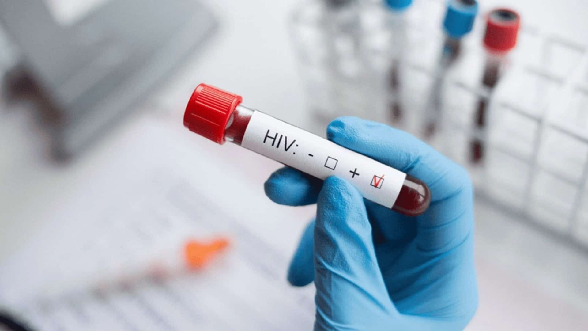 hiv-1-1920x1080