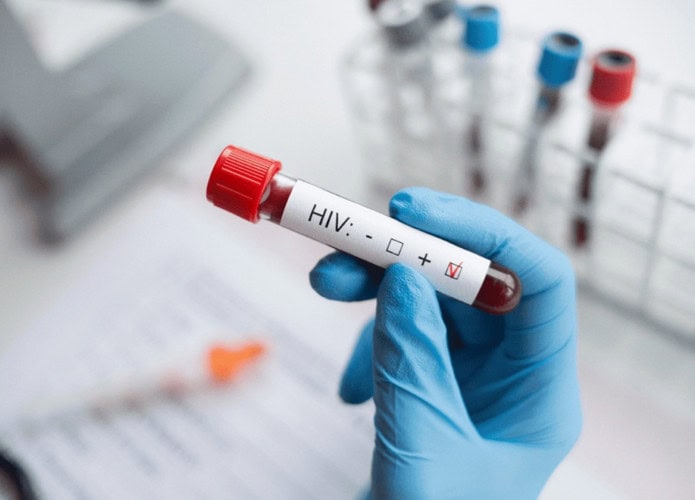 hiv-1-695x500