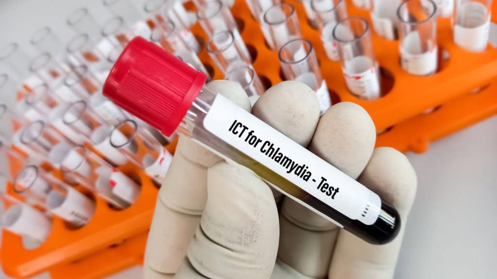 Amostra de sangue para teste de clamídia (ICT), doença sexualmente transmissível comum causada pela bactéria Chlamydia trachomatis