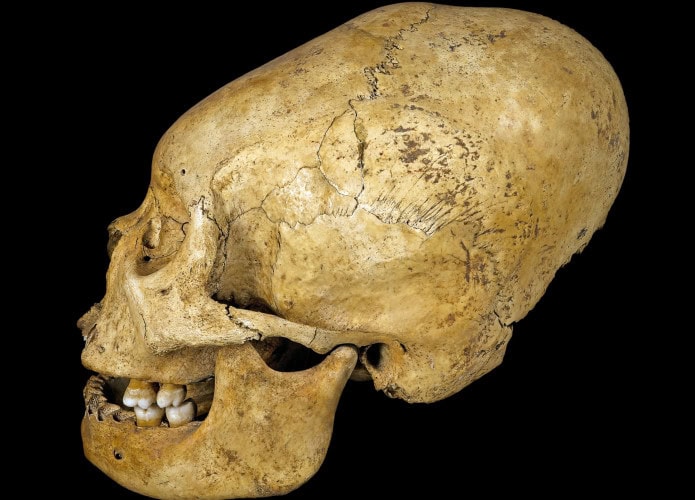 Crnio-alongado-encontrado-no-Peru-h-mais-de-2-mil-anos-695x500