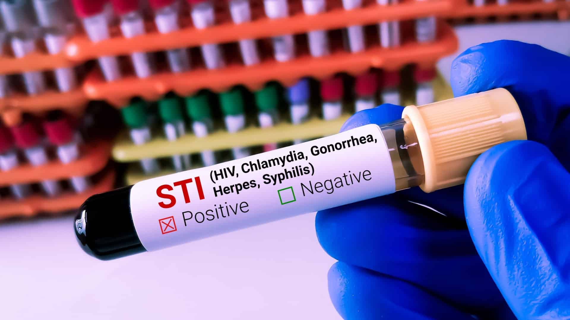 Bioquímico ou tecnólogo de laboratório segura amostra de sangue para teste de IST (Infecção Sexualmente Transmissível), com fundo de laboratório.