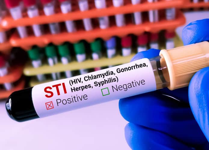 Bioquímico ou tecnólogo de laboratório segura amostra de sangue para teste de IST (Infecção Sexualmente Transmissível), com fundo de laboratório.