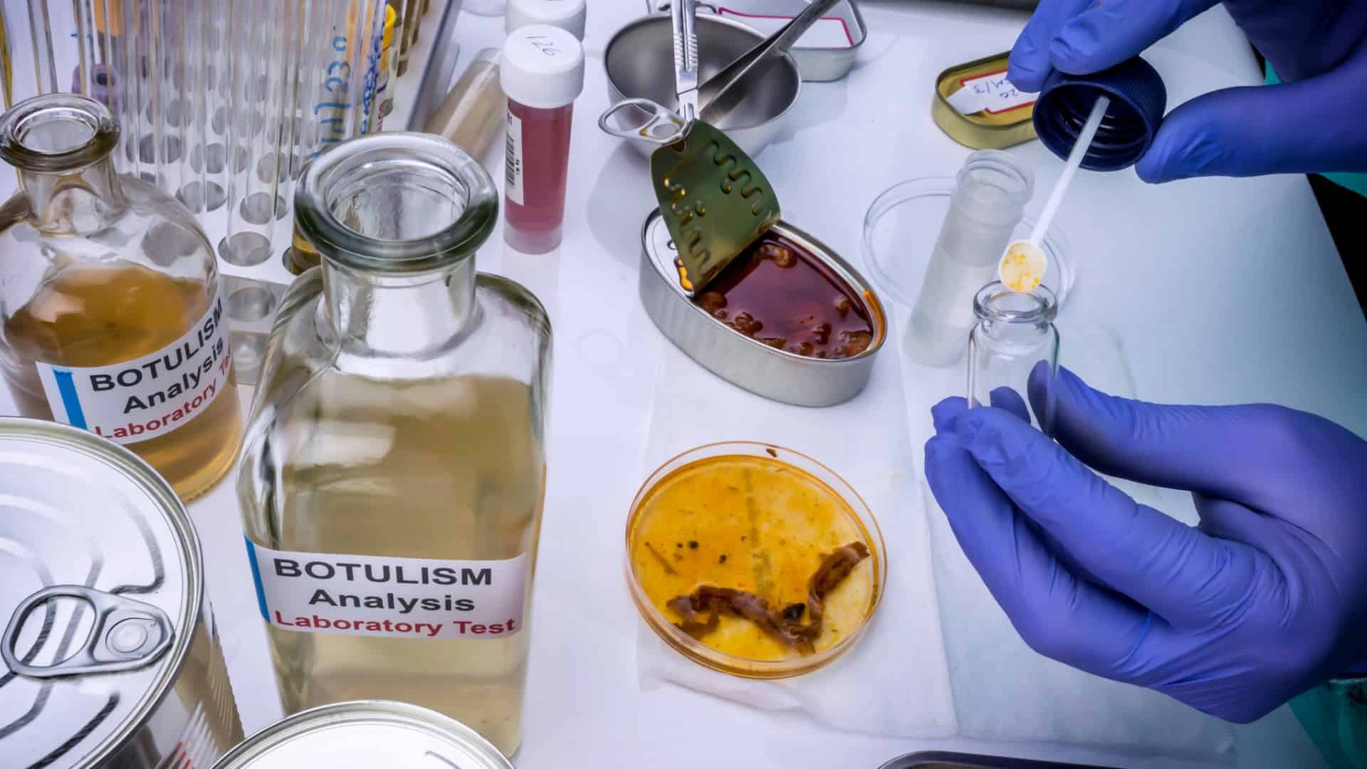 Botulismo