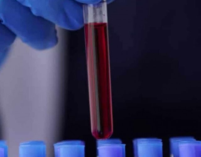 Capa - sangue