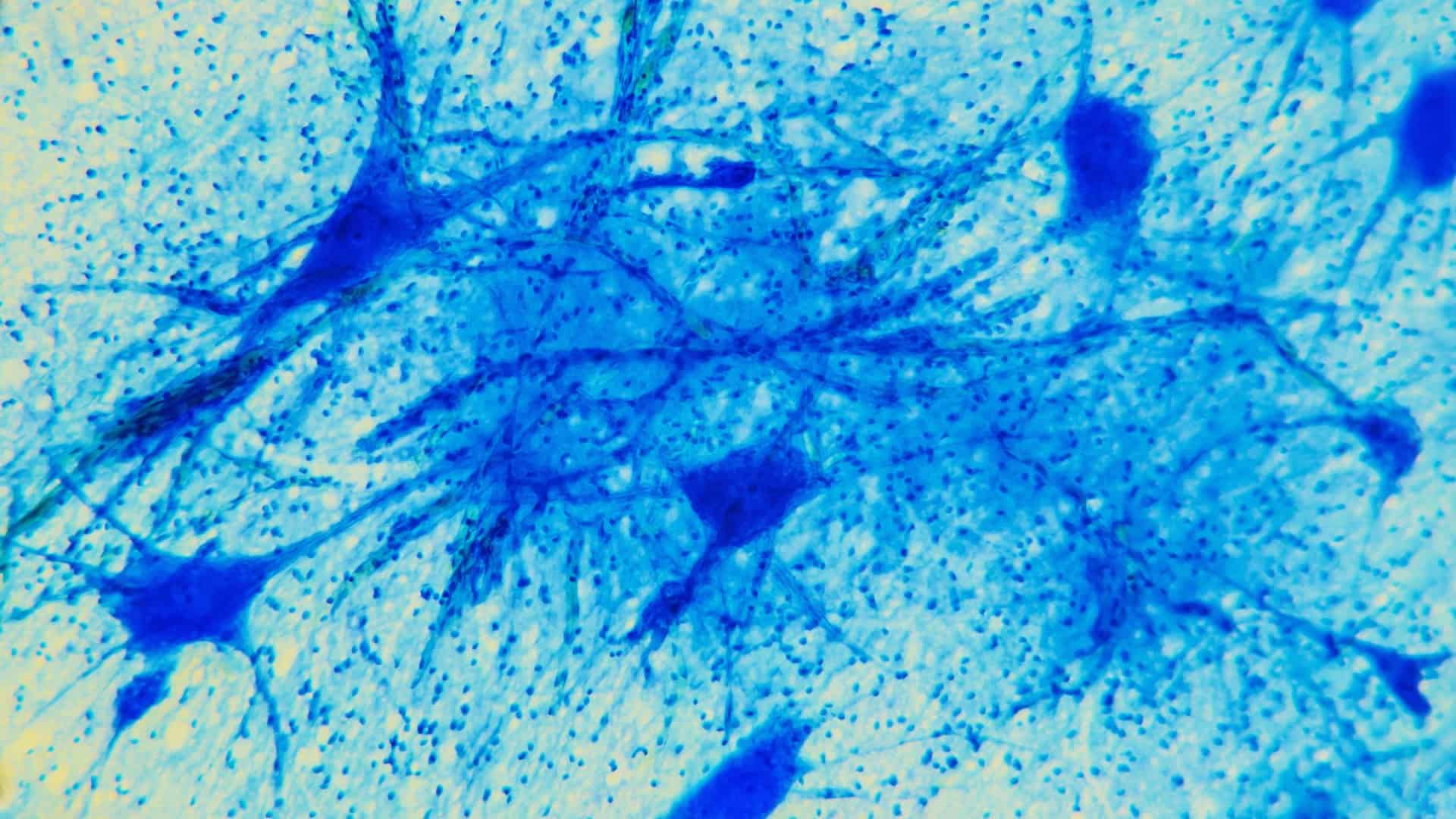 neuronios