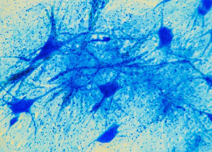 neuronios