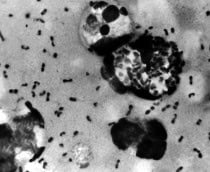 peste-negra-1-210x172