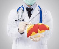 Médico mostrando fígado com gordura, doença hepática em fundo branco.