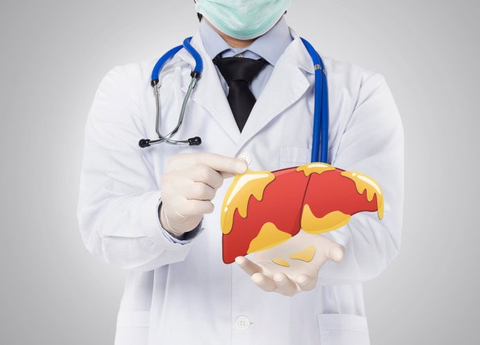 Médico mostrando fígado com gordura, doença hepática em fundo branco.