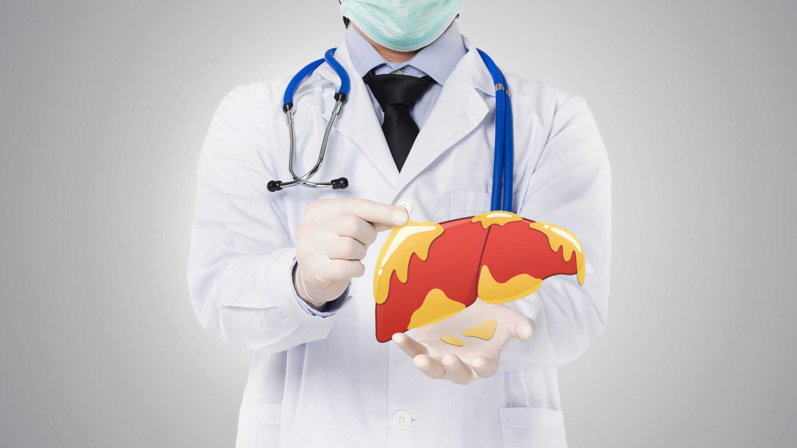 Gordura no fígado é grave? Veja sintomas e como tratar a esteatose hepática