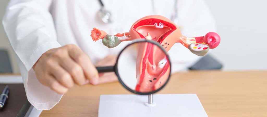 Médica com modelo anatômico de útero e ovários e lupa. Câncer de ovário e colo do útero e distúrbios do colo do útero
