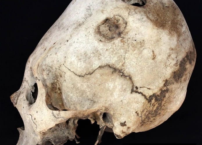 cranio-peru-1-695x500