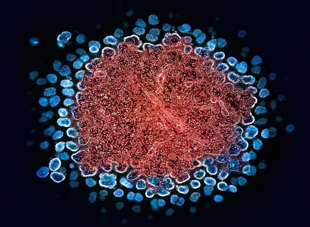 imagem ampliada do vírus do HIV