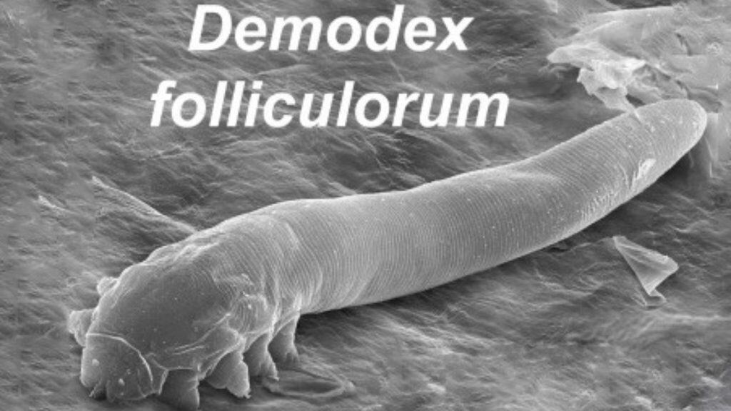 Demodex