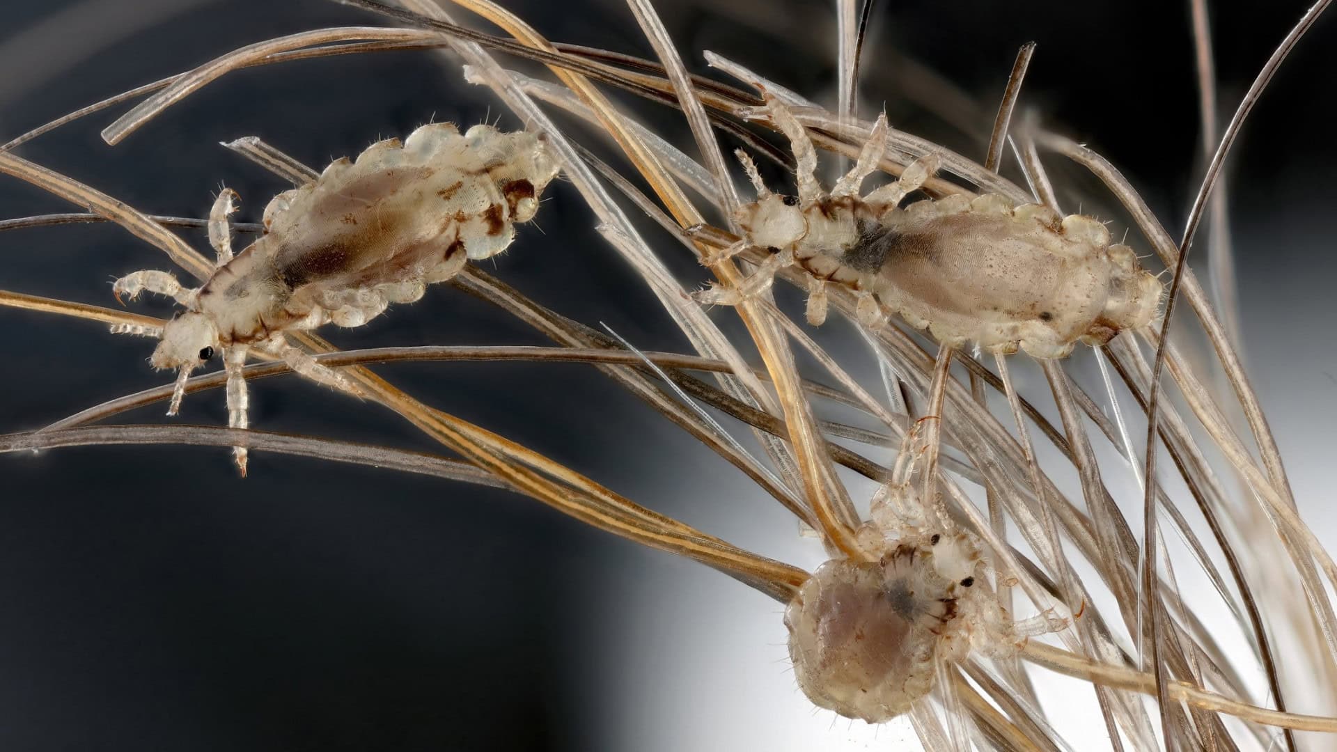 Piolho (Pediculus humanus capitis)