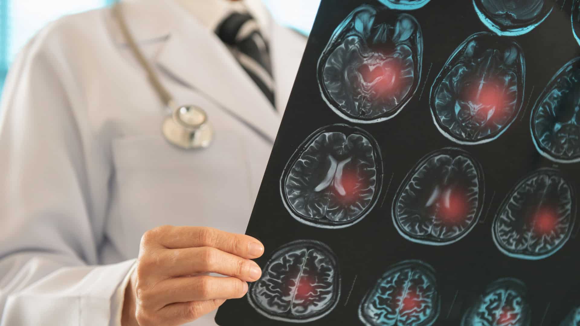 Médico olhando uma tomografia