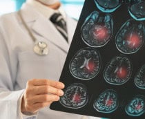 Médico olhando uma tomografia