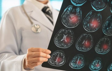 Médico olhando uma tomografia