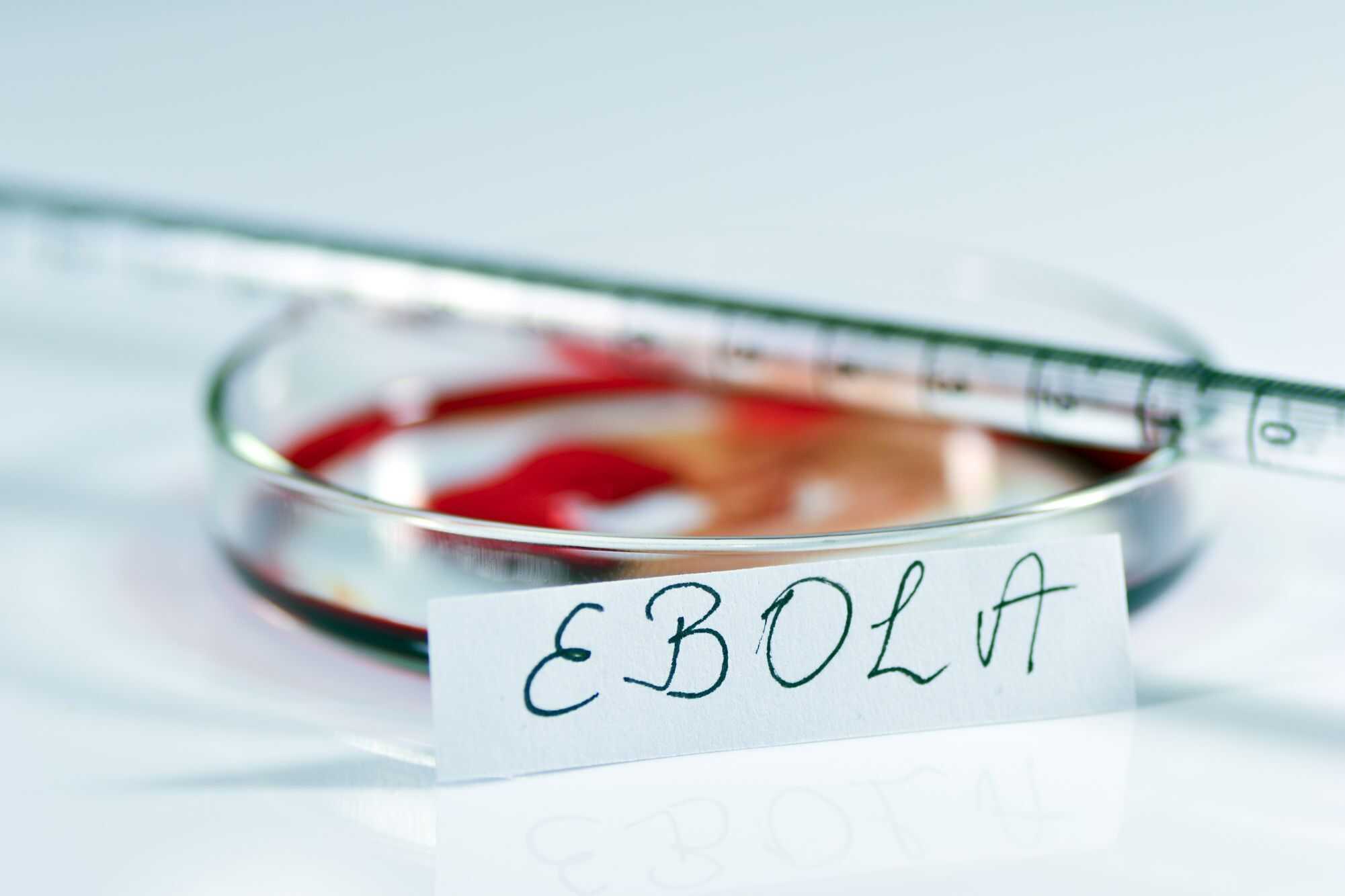 Ministro de Saúde do Congo nega que surto de Ebola esteja “fora de controle”
