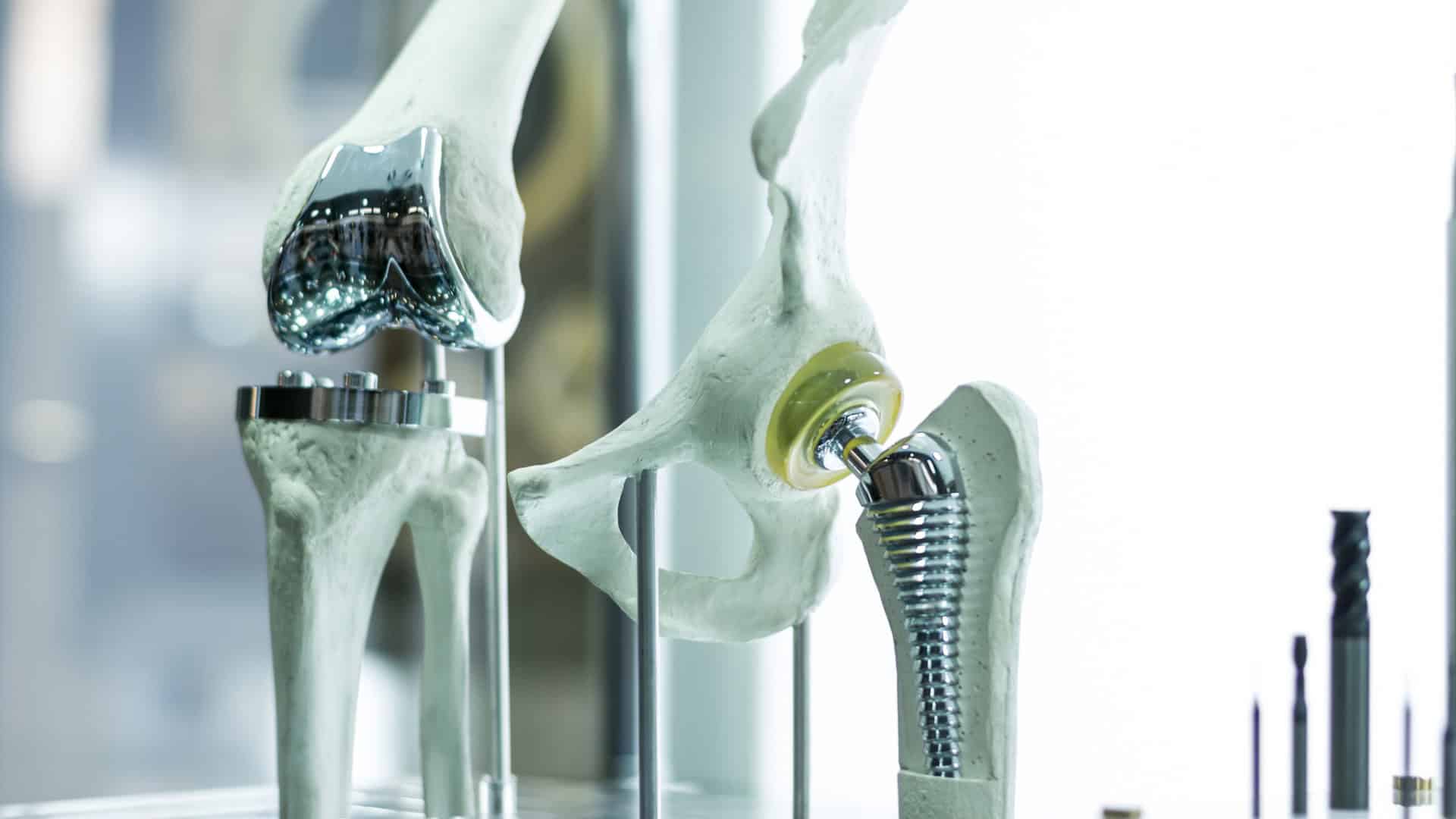 implantes