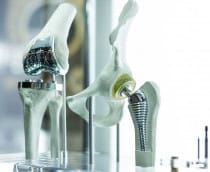 implantes